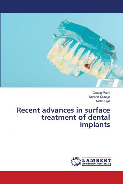 Recent advances in surface treatment of dental implants