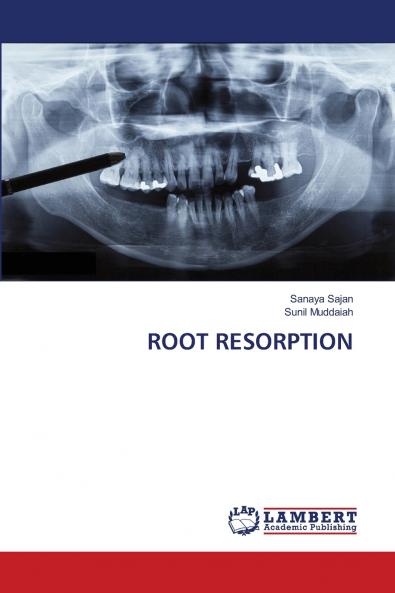 ROOT RESORPTION