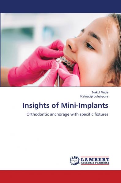 Insights of Mini-Implants