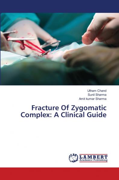 Fracture Of Zygomatic Complex