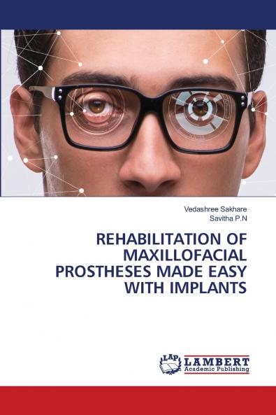 REHABILITATION OF MAXILLOFACIAL PROSTHESES MADE EASY WITH IMPLANTS