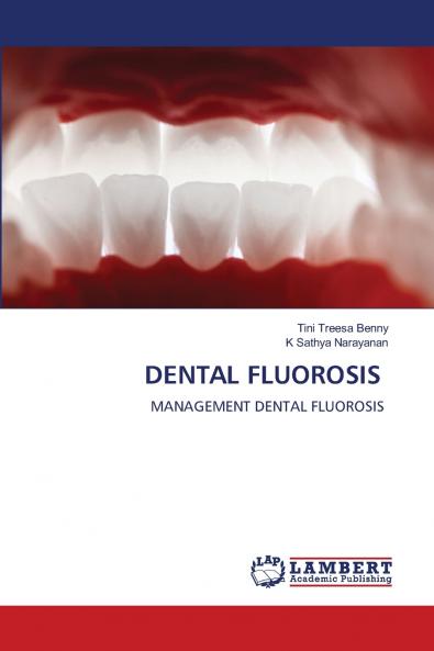 DENTAL FLUOROSIS