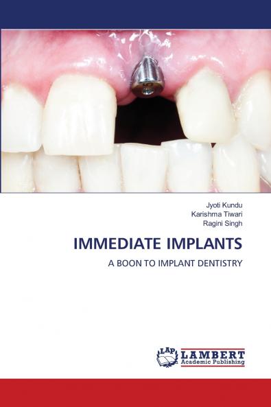 IMMEDIATE IMPLANTS