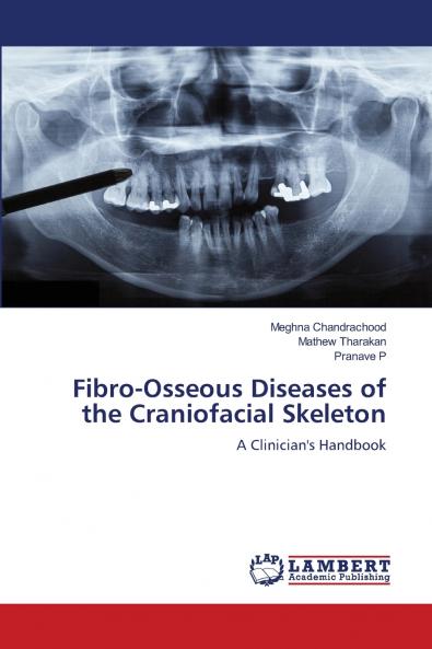 Fibro-Osseous Diseases of the Craniofacial Skeleton
