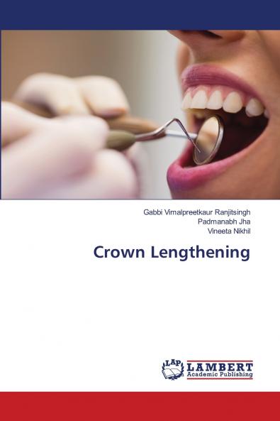 Crown Lengthening