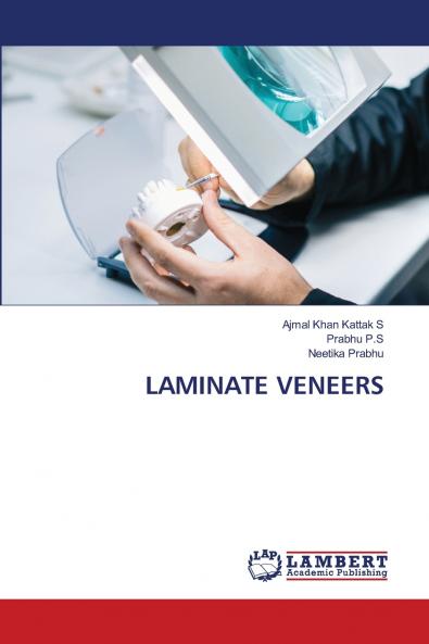 LAMINATE VENEERS