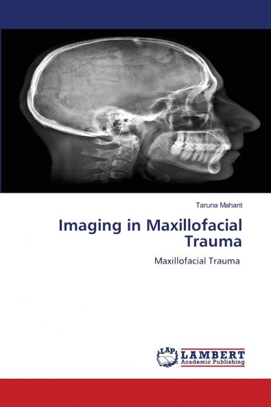 Imaging in Maxillofacial Trauma