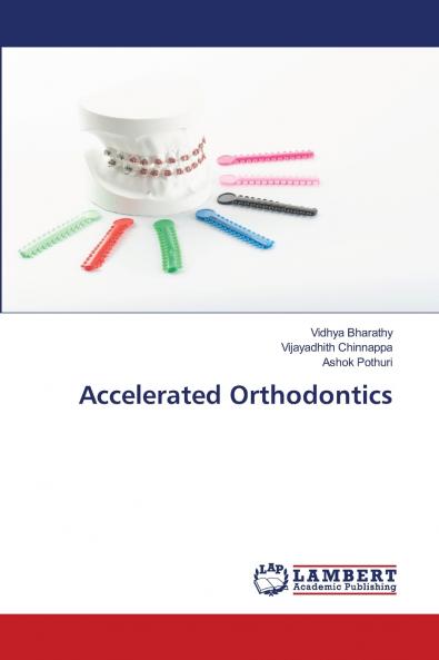 Accelerated Orthodontics