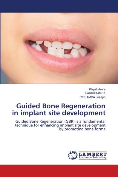 Guided Bone Regeneration in implant site development