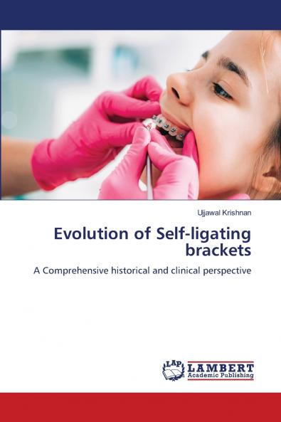 Evolution of Self-ligating brackets