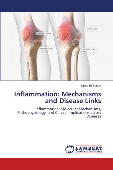 Inflammation