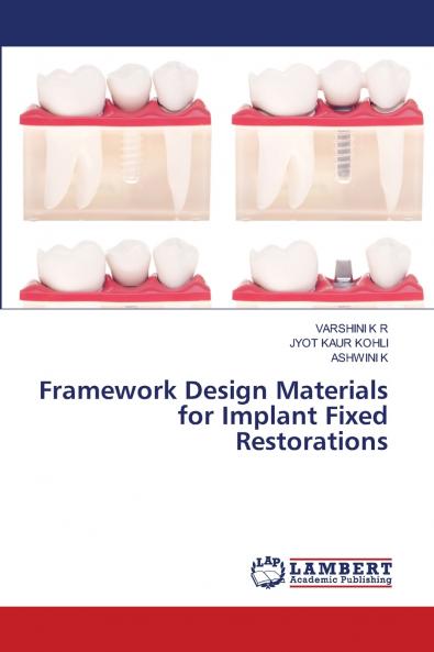 Framework Design Materials for Implant Fixed Restorations