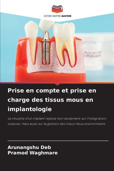 Prise en compte et prise en charge des tissus mous en implantologie