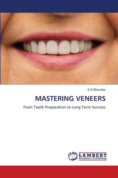 MASTERING VENEERS