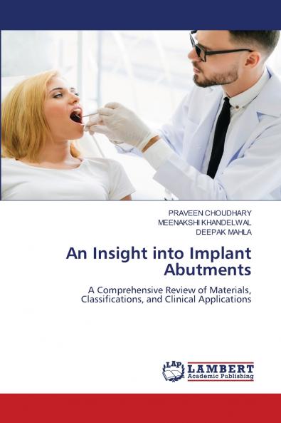An Insight into Implant Abutments