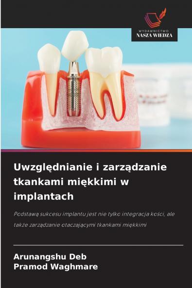 Uwzględnianie i zarządzanie tkankami miękkimi w implantach