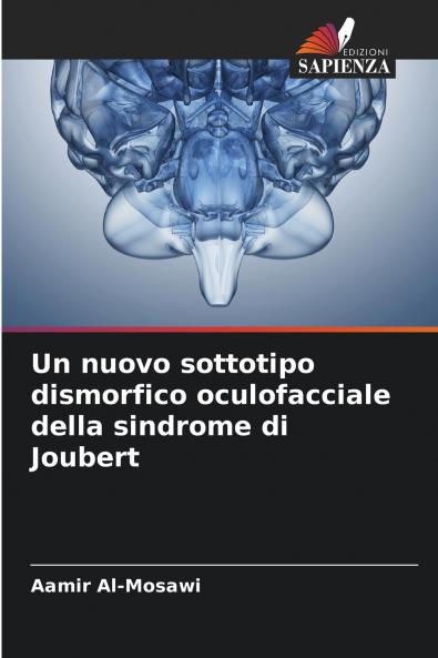Un nuovo sottotipo dismorfico oculofacciale della sindrome di Joubert
