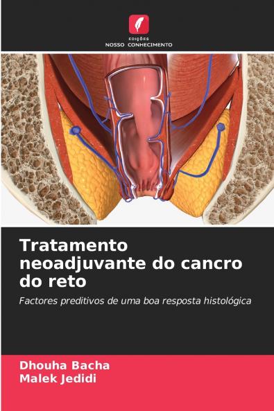 Tratamento neoadjuvante do cancro do reto