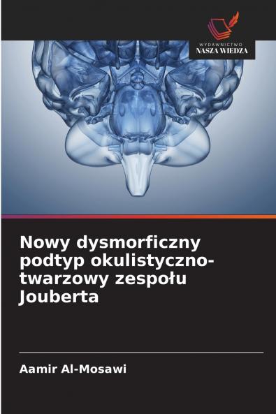 Nowy dysmorficzny podtyp okulistyczno-twarzowy zespołu Jouberta