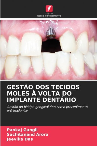 GESTÃO DOS TECIDOS MOLES À VOLTA DO IMPLANTE DENTÁRIO