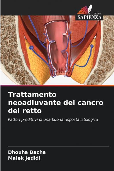 Trattamento neoadiuvante del cancro del retto