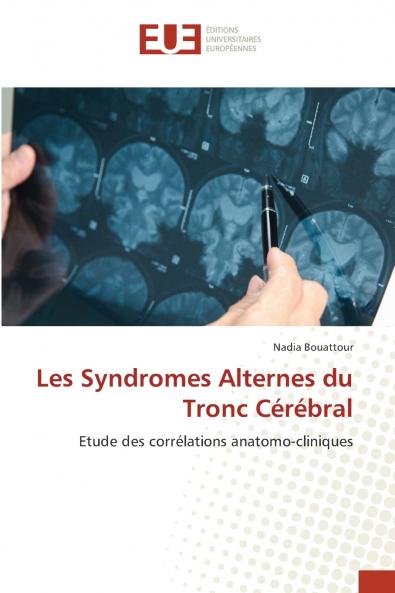 Les Syndromes Alternes du Tronc Cérébral