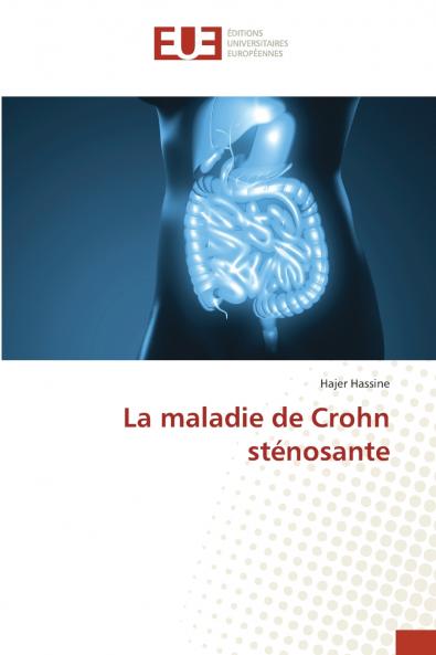 La maladie de Crohn sténosante