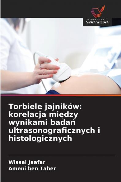 Torbiele jajników