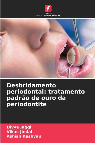 Desbridamento periodontal