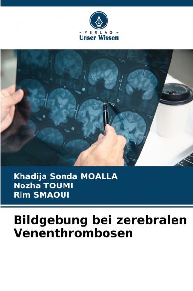 Bildgebung bei zerebralen Venenthrombosen