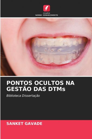 PONTOS OCULTOS NA GESTÃO DAS DTMs