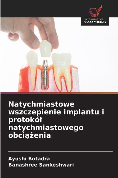 Natychmiastowe wszczepienie implantu i protokó? natychmiastowego obci??enia