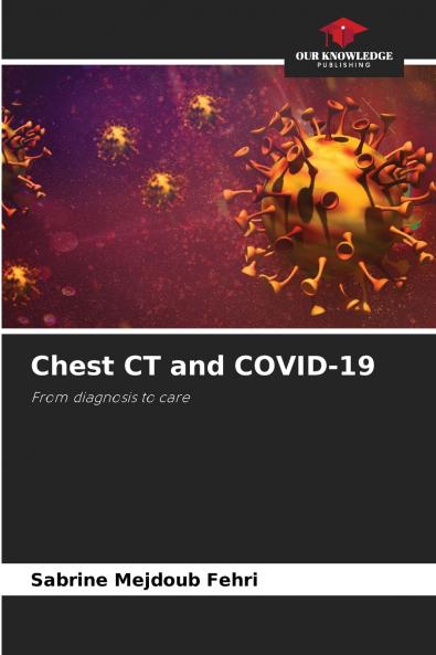 Chest CT and COVID-19