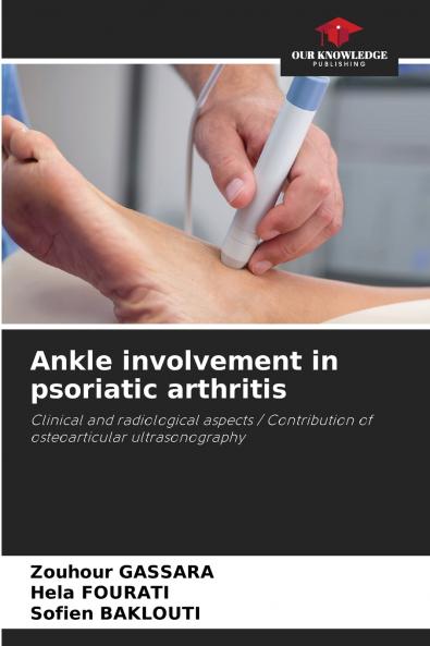 Ankle involvement in psoriatic arthritis