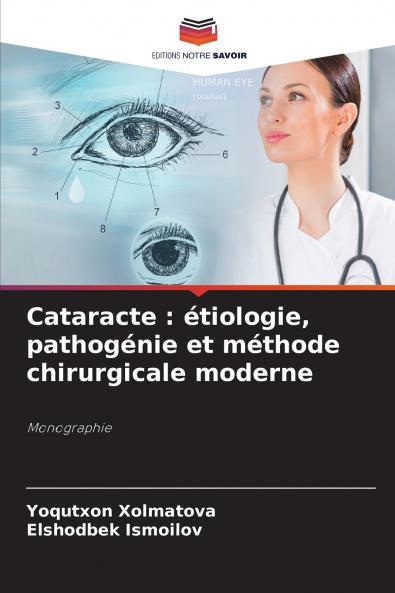 Cataracte