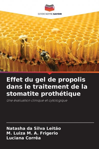 Effet du gel de propolis dans le traitement de la stomatite prothétique