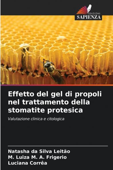 Effetto del gel di propoli nel trattamento della stomatite protesica