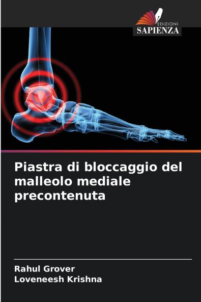 Piastra di bloccaggio del malleolo mediale precontenuta