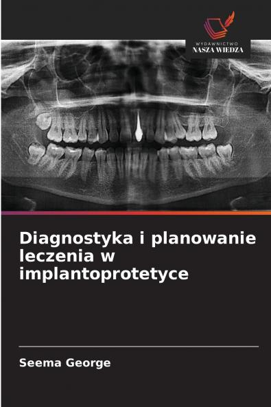 Diagnostyka i planowanie leczenia w implantoprotetyce
