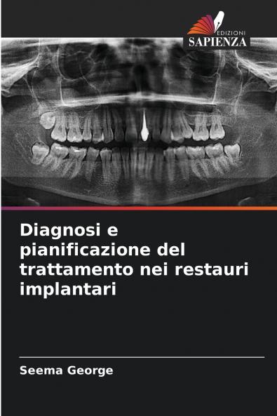 Diagnosi e pianificazione del trattamento nei restauri implantari