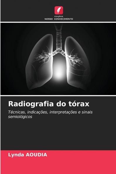 Radiografia do tórax