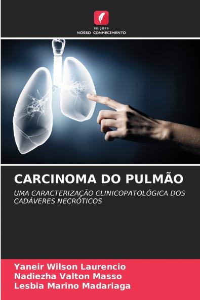 CARCINOMA DO PULMÃO