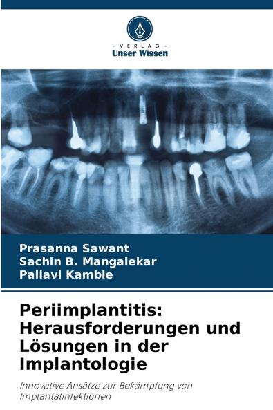 Periimplantitis