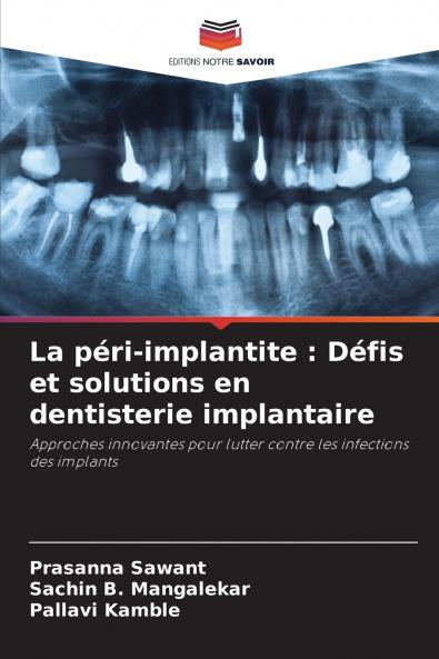La péri-implantite
