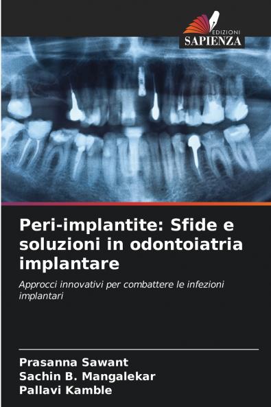 Peri-implantite