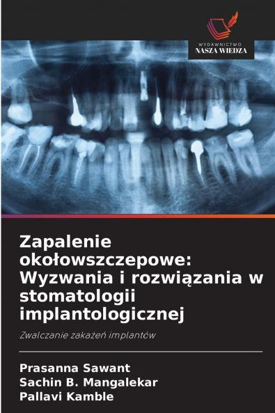 Zapalenie okołowszczepowe
