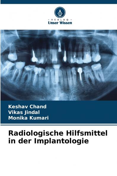 Radiologische Hilfsmittel in der Implantologie