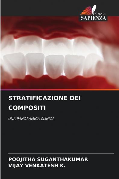 STRATIFICAZIONE DEI COMPOSITI