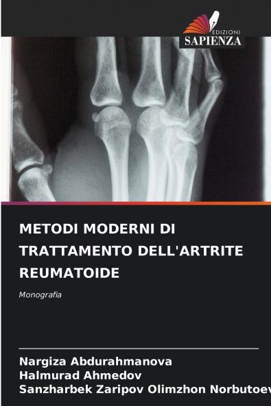 METODI MODERNI DI TRATTAMENTO DELL'ARTRITE REUMATOIDE