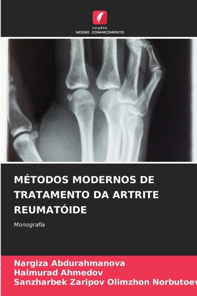 MÉTODOS MODERNOS DE TRATAMENTO DA ARTRITE REUMATÓIDE